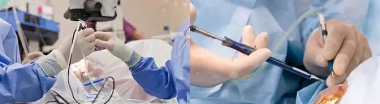 Хирургия за възстановяване на зрението